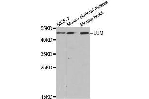 Western blot analysis of extracts of various cell lines, using LUM antibody. (LUM antibody  (AA 19-338))