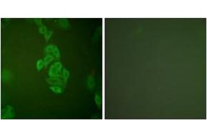 Immunofluorescence analysis of A549 cells, using NSE Antibody. (ENO2/NSE antibody  (AA 371-420))