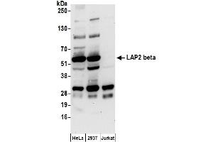 Western Blotting (WB) image for anti-LAP2 beta/tmpo (AA 225-275) antibody (ABIN7455055) (LAP2 beta/tmpo (AA 225-275) antibody)