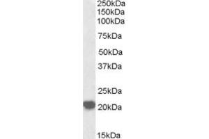 Image no. 1 for anti-Ras-Related C3 Botulinum Toxin Substrate 2 (Rho Family, Small GTP Binding Protein Rac2) (RAC2) (AA 179-192) antibody (ABIN299359) (RAC2 antibody  (AA 179-192))