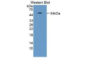 Detection of Recombinant LFA3, Human using Polyclonal Antibody to Cluster Of Differentiation 58 (CD58) (CD58 antibody  (AA 1-214))