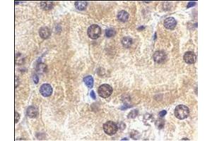 Immunohistochemistry of ST2 in mouse kidney tissue with this product at 2 μg/ml. (IL1RL1 antibody  (N-Term))