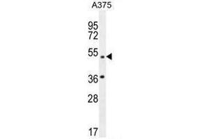 AP1M1 Antibody (Center) western blot analysis in A375 cell line lysates (35µg/lane). (AP1M1 antibody  (Middle Region))