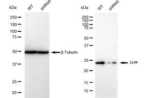 Western blotting analysis using CLPP antibody (ABIN7798100).