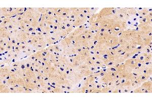 Detection of NRP1 in Human Cardiac Muscle Tissue using Monoclonal Antibody to Neuropilin 1 (NRP1) (Neuropilin 1 antibody  (AA 646-814))