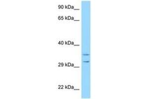 Image no. 1 for anti-Ribosomal Protein S2 (RPS2) (AA 99-148) antibody (ABIN6748128)