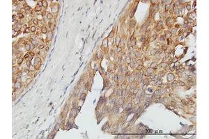 Image no. 1 for anti-Alveolar Soft Part Sarcoma Chromosome Region, Candidate 1 (ASPSCR1) (AA 1-554) antibody (ABIN466238) (ASPSCR1 antibody  (AA 1-554))