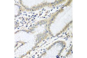 Immunohistochemistry of paraffin-embedded human stomach using RPN2 antibody at dilution of 1:100 (40x lens). (Ribophorin II antibody)