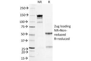 SDS-PAGE Analysis Purified Serum Amyloid A Mouse Monoclonal Antibody (SAA/326). (SAA antibody)