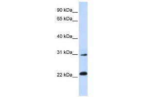 AP3S1 antibody used at 1 ug/ml to detect target protein. (AP3S1 antibody  (N-Term))
