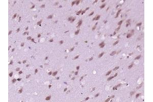 Paraformaldehyde-fixed, paraffin embedded mouse brain, Antigen retrieval by boiling in sodium citrate buffer (pH6) for 15min, Block endogenous peroxidase by 3% hydrogen peroxide for 30 minutes, Blocking buffer (normal goat serum) at 37°C for 20min, Antibody incubation with INPPL1(Tyr1135) Polyclonal Antibody  at 1:400 overnight at 4°C, followed by a conjugated secondary and DAB staining. (INPPL1 antibody  (pTyr1135))