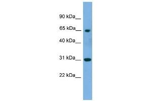 PNKP antibody used at 1 ug/ml to detect target protein. (PNKP antibody  (Middle Region))