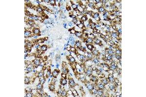 Immunohistochemistry of paraffin-embedded rat liver using HSP Rabbit mAb (ABIN7267580) at dilution of 1:100 (40x lens). (HSPA4 antibody)