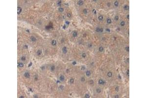 Figure. (RBP4 antibody  (AA 18-201))