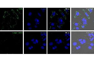 ZIP6 was detected in live human breast adenocarcinoma MCF7 cells by confocal microscopy using Anti-ZIP6/SLC39A6 (extracellular) Antibody (ABIN7043725, 1:25), followed by goat anti-rabbit secondary antibody conjugated to Alexa Fluor® 488 (green).