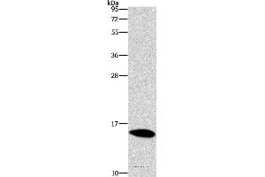 Western blot analysis of Mouse brain tissue, using CST4 Polyclonal Antibody at dilution of 1:1450 (CST4 antibody)