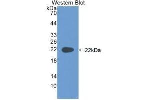 Detection of Recombinant KRT4, Rat using Monoclonal Antibody to Cytokeratin 4 (CK4) (KRT4 antibody  (AA 317-454))