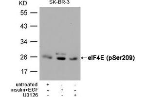 Western blot analysis of extracts from SK-BR-3 cells, untreated or insulin and EGF treated, and pretreated with U0126 cells, using eIF4E (Phospho-Ser209) Antibody. (EIF4E antibody  (pSer209))