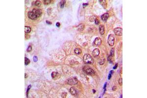 Immunohistochemistry (IHC) image for anti-C-Abl Oncogene 1, Non-Receptor tyrosine Kinase (ABL1) (N-Term), (pTyr204) antibody (ABIN7301468)