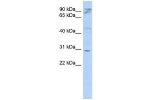 HAX1 antibody used at 1 ug/ml to detect target protein. (HAX1 antibody  (Middle Region))
