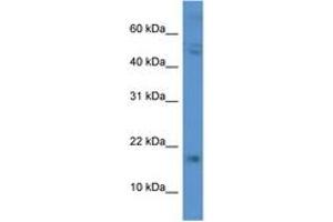 Image no. 1 for anti-Chorionic Gonadotropin, beta Polypeptide (CGB) (C-Term) antibody (ABIN6746758) (CGB antibody  (C-Term))