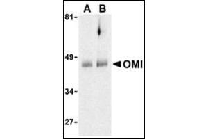 Western blot analysis of OMI in human colon cell lysates with this product at (A) 0.