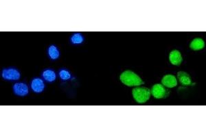 IF analysis of Sumo 1/SUMO1 using anti-Sumo 1/SUMO1 antibody (ABIN7603002).