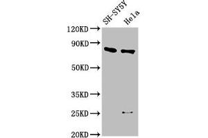 Western Blot Positive WB detected in: SH-SY5Y whole cell lysate, Hela whole cell lysate All lanes: CTNNB1 antibody at 2. (CTNNB1 antibody  (AA 2-781))