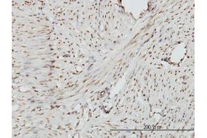 Image no. 1 for anti-Zinc Fingers and Homeoboxes 2 (ZHX2) (AA 691-789) antibody (ABIN599184)