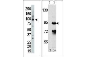 Image no. 1 for anti-rho GTPase Activating Protein 26 (ARHGAP26) (Middle Region) antibody (ABIN360552) (GRAF antibody  (Middle Region))