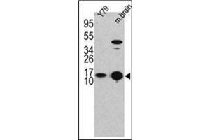 Western blot analysis of LC3B Antibody (LC3B antibody  (N-Term))
