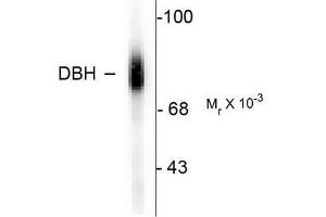 Image no. 1 for anti-Dopamine beta-Hydroxylase (Dopamine beta-Monooxygenase) (DBH) (C-Term) antibody (ABIN372611) (DBH antibody  (C-Term))
