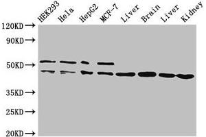 Western Blot Positive WB detected in: HEK293 whole cell lysate, Hela whole cell lysate, HepG2 whole cell lysate, MCF-7 whole cell lysate, Rat liver tissue, Mouse brain tissue, Mouse liver tissue, Mouse kidney tissue All lanes: IDH1 antibody at 2 μg/mL Secondary Goat polyclonal to rabbit IgG at 1/50000 dilution Predicted band size: 47 kDa Observed band size: 47, 52 kDa (IDH1 antibody  (AA 1-240))