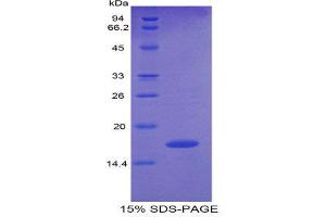 SDS-PAGE (SDS) image for Pleiotrophin (PTN) (AA 33-168) protein (His tag) (ABIN1171133)