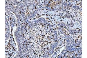 IHC analysis of HLA-DRA using anti-HLA-DRA antibody (ABIN7600948). (HLA-DRA antibody  (AA 26-254))