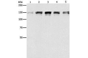 Western Blot analysis of Human fetal small intestine, liver cancer and Lymphoma Lymphoma, 293T and A549 cell using DDB1 Polyclonal Antibody at dilution of 1:500 (DDB1 antibody)