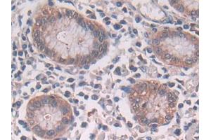 DAB staining on IHC-P; Samples: Human Stomach Tissue (CBL antibody  (AA 558-816))