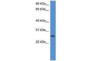 Mouse Kidney; WB Suggested Anti-Chodl Antibody Titration: 0. (CHODL antibody  (C-Term))