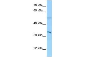 WB Suggested Anti-CD1B Antibody Titration: 1.