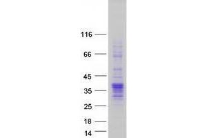 Western Blotting (WB) image for Vestigial Like 4 (VGLL4) (Transcript Variant 1) protein (Myc-DYKDDDDK Tag) (ABIN2735254)