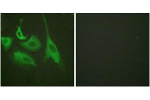 Immunofluorescence analysis of HeLa cells treated with TNF-a 20nM 15', using HSP90B (Phospho-Ser254) Antibody. (HSP90AB1 antibody  (pSer254))