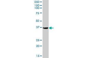 AKR1C4 MaxPab polyclonal antibody. (AKR1C4 antibody  (AA 1-323))