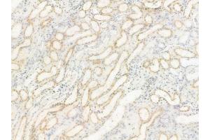 ABIN6264978 and ABIN6278527 at 1/100 staining human normal kidney tissue by IHC-P.