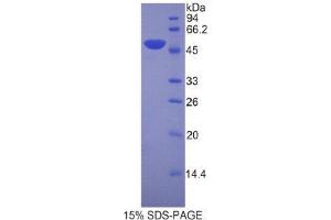 SDS-PAGE (SDS) image for Left-Right Determination Factor 1 (LEFTY1) (AA 169-368) protein (His tag,GST tag) (ABIN1878257) (LEFTY1 Protein (AA 169-368) (His tag,GST tag))