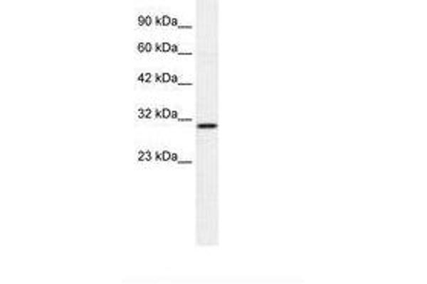 ZNHIT6 antibody  (AA 300-349)