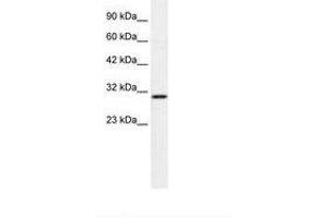 ZNHIT6 antibody  (AA 300-349)