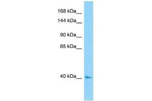 Western Blotting (WB) image for anti-Centrosomal Protein 120kDa (CEP120) (N-Term) antibody (ABIN2790462) (CEP120 antibody  (N-Term))