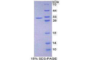 SDS-PAGE (SDS) image for Ataxin 1 (ATXN1) (AA 331-587) protein (His tag) (ABIN2124074) (Ataxin 1 Protein (ATXN1) (AA 331-587) (His tag))