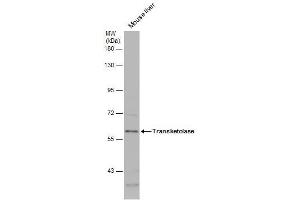 WB Image Mouse tissue extract (50 μg) was separated by 7. (TKT antibody)