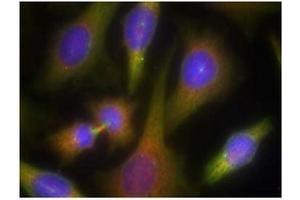 Image no. 2 for anti-Eukaryotic Translation Initiation Factor 2-alpha Kinase 2 (EIF2AK2) (Thr451) antibody (ABIN197555) (EIF2AK2 antibody  (Thr451))